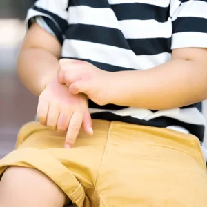 كشف حساسية غذائية فقط